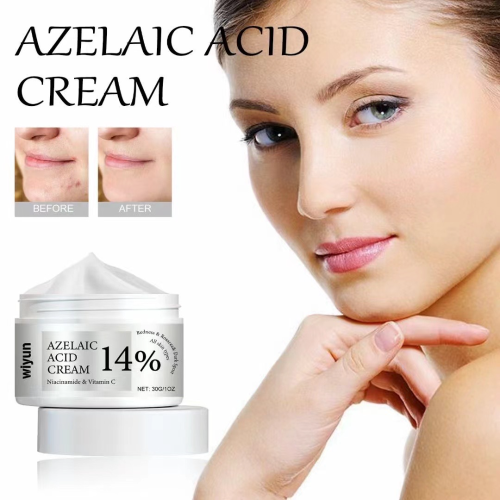azelaic acid cream nicotinamide acne cream